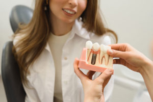 Dental Patient Getting Shown A Dental Implant Model
